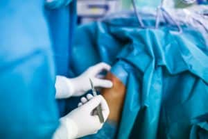 Knee Revision Harrison NY