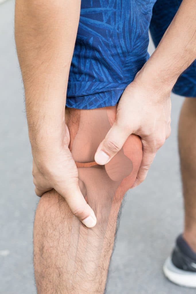 Knee Arthroplasty Westchester County NY