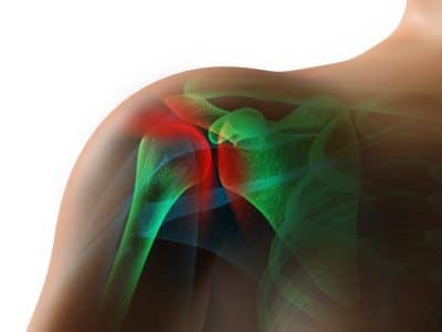 Shoulder Pain Injury