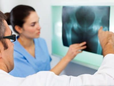 Doctor looking at X-ray image of a pelvis