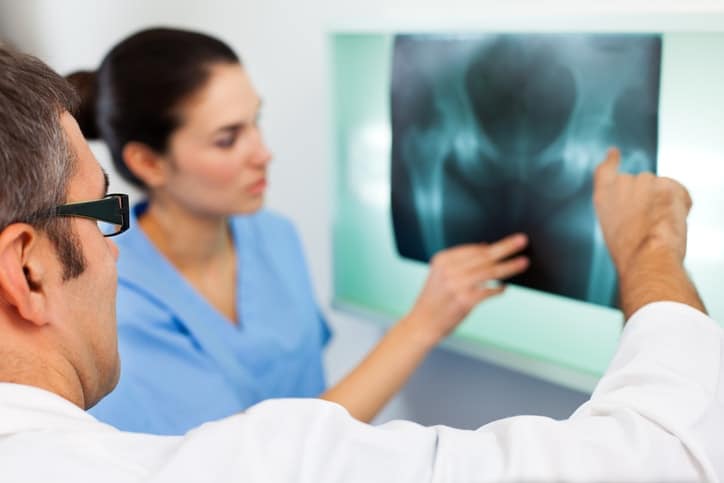 Doctor looking at X-ray image of a pelvis
