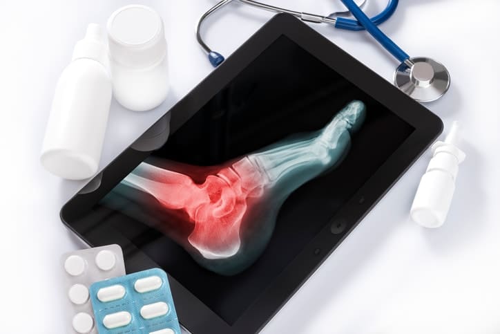 X-Ray Image of an Ankle