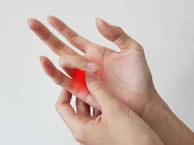 trigger finger
