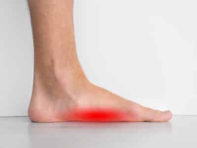 Foot pain because of strong flat feet also called pes planus or fallen arches.