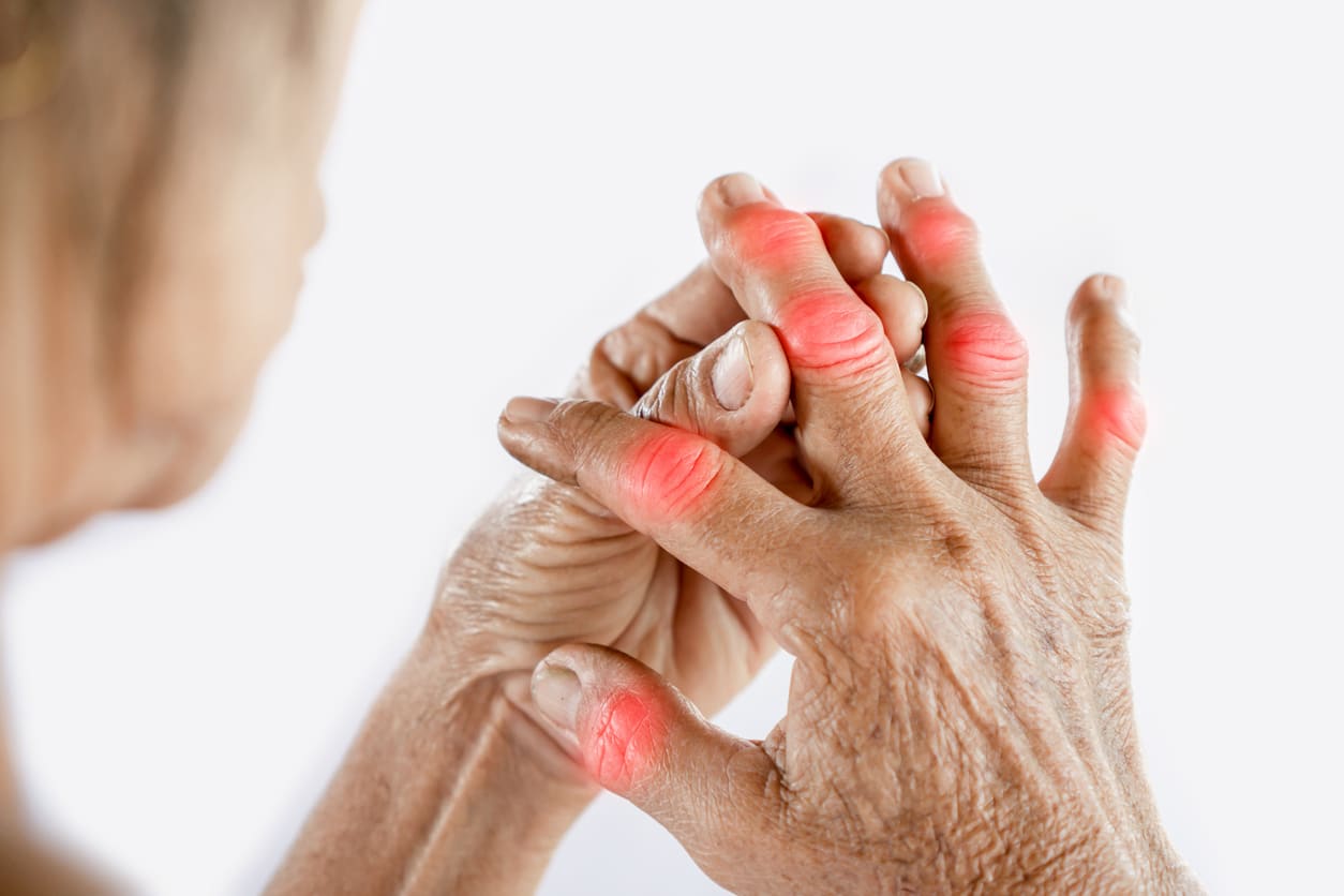 Metacarpophalangeal Joint Arthroplasty Westchester County NY