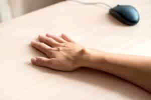 A woman with a ganglion cyst placing her hand on a table